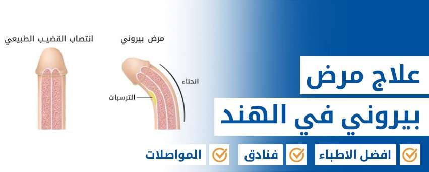 علاج مرض بيروني